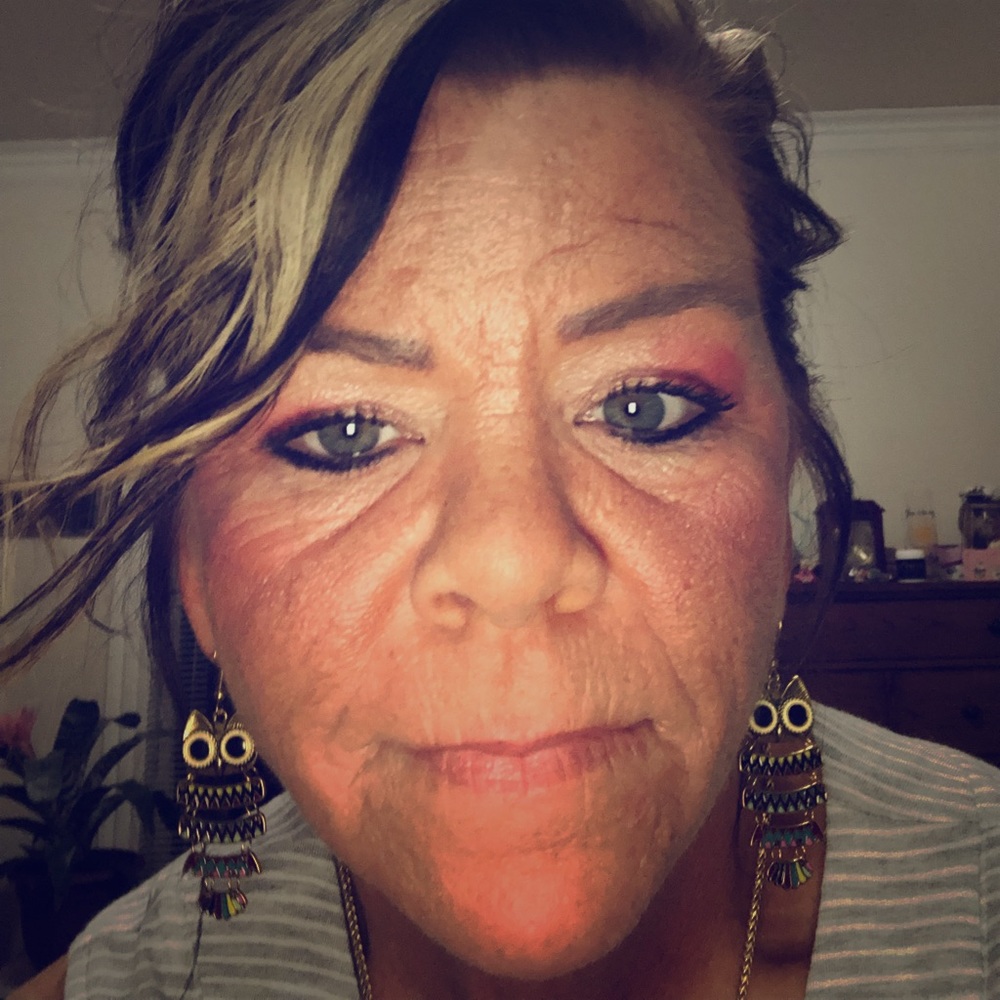 Hi I’m Kimberly. Recently lost a lot of weight